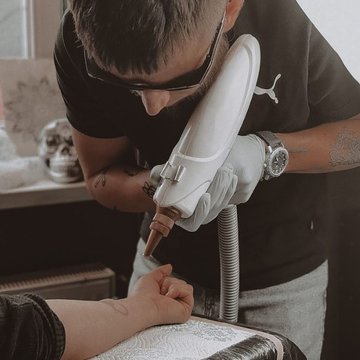 Discounts on Repeat Tattoo Removal